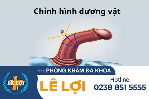 Chinh-hinh-duong-vat